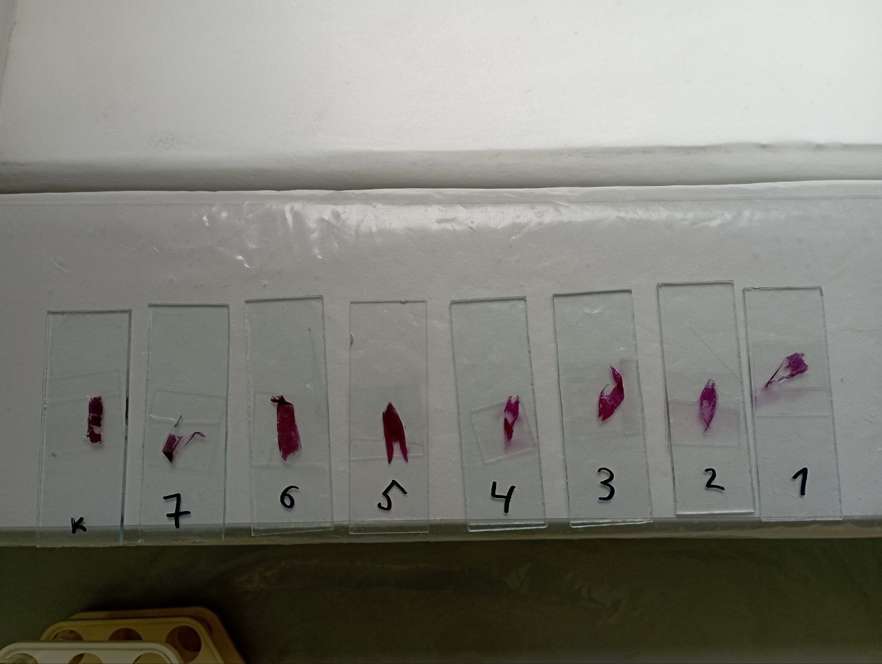 photo 5399920798120146851 y